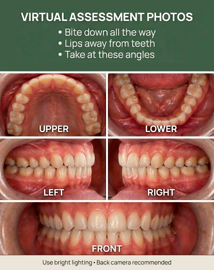 Virtual assessment photo guide showing required angles: upper, lower, left, right, and front.