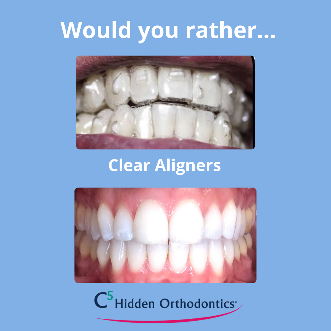 Would you rather graphic