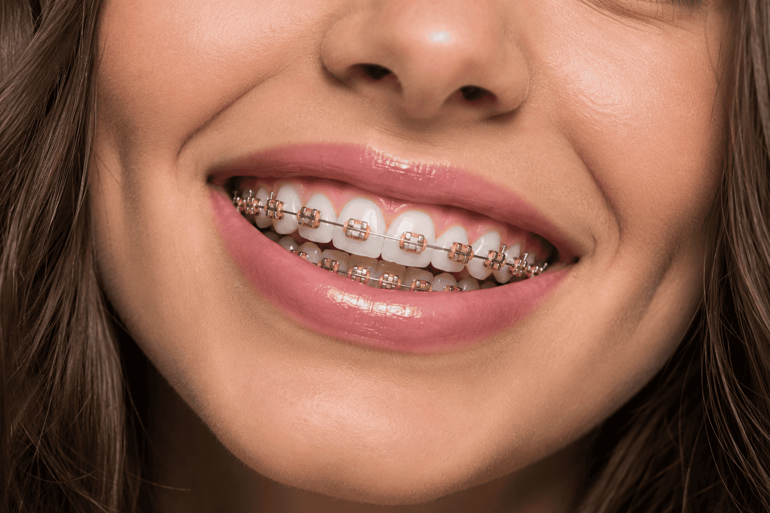 Close-up of a smiling patient with gold-tone braces at Elite Orthodontics Studio in Garden City, NY