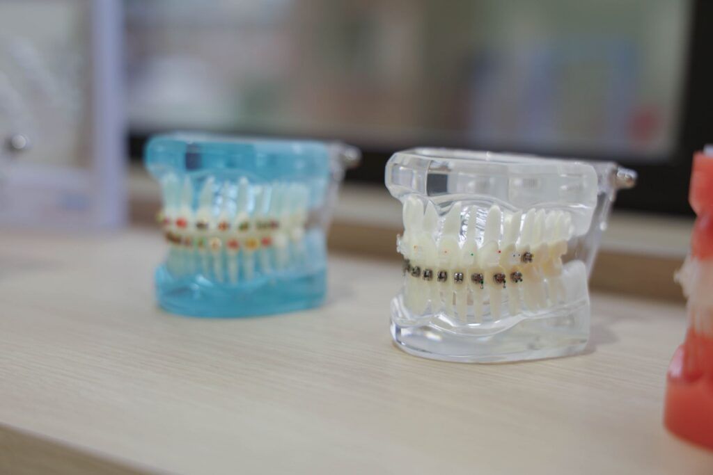 Elite Orthodontics Studio office display of dental models with braces